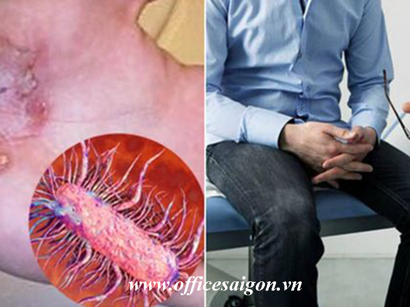 Những điều nên biết về vi khuẩn ăn thịt người